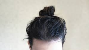 Was hilft gegen fettige haare und was die ursachen sind, verraten wir hier. Die Besten Frisuren Tricks Bei Fettigen Haaren