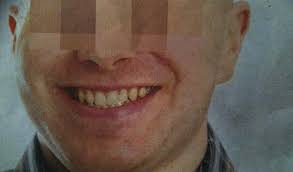 Het syndroom van asperger wordt soms ook hoogfunctionerend autisme genoemd en valt daarmee onder ass. Spermadonor Verzwijgt Syndroom Van Asperger Gezond Ad Nl