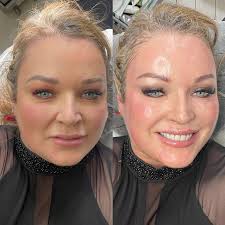 Profile for Suzanne Wylde Permanent Cosmetics & Medical Micropigmentation