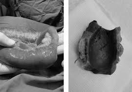 Your veterinarian will provide you with a treatment plan for your cat, but it might include stabilizing them if they're dehydrated, laxatives, endoscopy and—as a last resort—surgery. Gastrointestinal Obstructions In Dogs Gastrointestinal Tract Treatment Brisbane