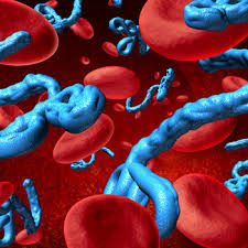 The average evd case fatality rate is around 50%. Ebola Virus Disease Important Aspects For The Food Science And Technology Community