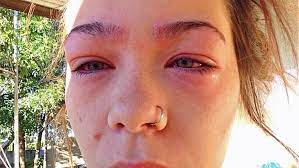 You want it to appear perfect so you don't stain the sides of your eyes nor get dye on any other area especially the eyes. How Long Do You Leave Hair Dye On Eyebrows Eyebrowshaper