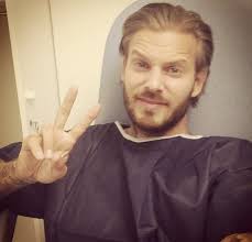 Matt Pokora à l'hôpital après s'être blessé pendant les répétitions de  "Robin des bois"