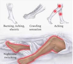 Image result for Restless Leg Syndrome