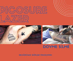 Instagram Da Dr Gokhan Gokler Dermatologist Picosure Bir Diger Adiyla Picosaniyeli Lazer Dovme Silme Ve Leke Tedavisinde Son Derece Etkili Sonuclar Ortay Lazer