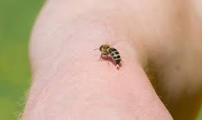 Was Tun Wenn Die Biene Sticht Bienen Natur