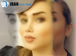 كم يبلغ متوسط تكلفة عملية تجميل الأنف في إيران Iran Nose Incoming Call Screenshot
