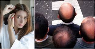 Now that the initial wave has subsided, what can we learn from this experience going forward? Covid Perdita Di Capelli Tra Gli Effetti Collaterali Ne Soffre Un Paziente Su 5 Anche Le Donne