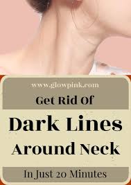 Get Rid Of Dark Lines Around Neck In Just 20 Minutes Darkskin Skincare Diyskincare Darkneck Da Skin Care Remedies Homemade Beauty Tips Natural Beauty Tips