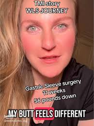 Embracing My Weight Loss Surgery Journey: Excitement & Nerves