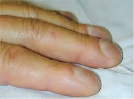 Image result for Digital Clubbing