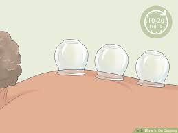 How To Do Cupping With Pictures Wikihow