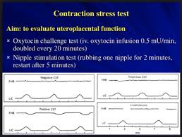 Image result for Contraction Stress Test