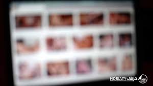 ادمان الجنس أهم الأسباب- الأعراض- طرق العلاج المتاحة