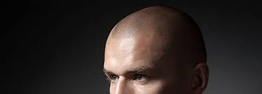 We have been instrumental in building communities throughout western canada and the canadian territories over the past 45 years. Smp Becoming Popular Solution For Hair Thinning Why The Widespread Interest Hair Transplant Dubai