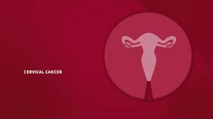 The point at which i knew something was wrong was when i had a bloody, smelly discharge. Cervical Cancer Early Signs Symptoms Precautions Jmexclusives