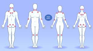 Shake off this downy sleep, death's counterfeit, and look on death itself! Costochondritis Chest Wall Pain Rib Injury Clinic