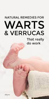 See full list on wikihow.com Get Rid Of Verrucas Naturally