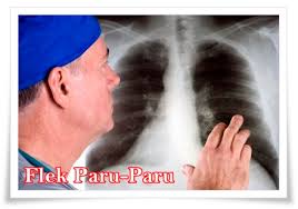 Check spelling or type a new query. Obat Batuk Tbc Flek Paru Paru Berair