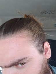 Baby Hairs Or Thinning Breakage R Manbunsandmanes