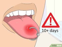 Inadequate fluids can result in swelling or scalloping of the tongue or a salivary gland infection. 3 Ways To Reduce Tongue Swelling Wikihow