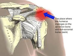 Sleeping on the unaffected side and sleeping on your back. Shoulder Pain After Sleeping And What You Can Do About It