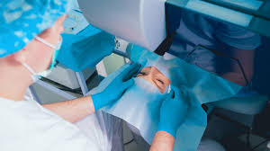 Transforming Lives Through Laser Eye Surgery