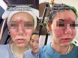 Expired Cosmetics: What Happens If You Use Them Carelessly?