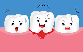 Image result for Post-Tooth Extraction Bleeding