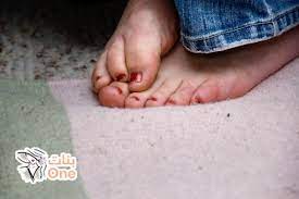 ما أسباب برودة الأطراف وتنميلها بنات one