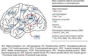 Image result for Parietal Lobe