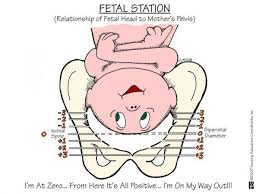 75 Punctilious Dilation Effacement Station Chart