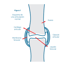 The word 'que' is another emphasis word. Artrosis Que Es Sintomas Diagnostico Y Tratamiento