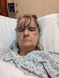 Just wanted to post and update from my prior post. This is my sister-in-law  Julie who was hit by a vehicle