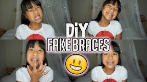 The one thing you should never do is buy into the new trend of diy braces. Diy Braces 7 Warnings To Why You Shouldn T Do It Dr Sam King Knows