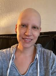 Hair growth after chemotherapy