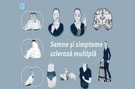 Recuperare medicala, kinetoterapie, fizioterapie, masaj terapeutic. Scleroza Multipla Cauze Complicatii Tratament Antena Satelor