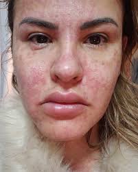 Les hago un resumen de lo que me paso y realmente quise compartir con  ustedes desde el comienzo. Seguro que algunos no estarán tan de acuerdo con  que exponga mi vida, pero