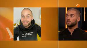 Zowel dave en donny roelvink lieten een tijd geleden hun tanden wegslijpen om vervolgens facings te nemen. M9uz0gb1vic Wm