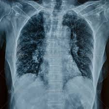 X Rays Background For Photography X Ray Ray Film