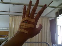 Demikianlah gambar henna tangan yang simple dan cantik. Kumpulan Gambar Tangan Di Infus Lengkap Iseng Nulis Menggambar Tangan Gambar Tangan