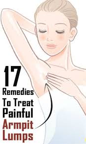 13 Home Remedies To Reduce Armpit Lumps Armpit Lump Swollen Lymph Nodes Epidermoid Cyst