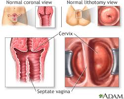 Hie Multimedia Developmental Disorders Of The Female Genital Tract