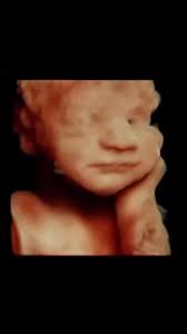 This little one already knows how to strike a pose! A true model in the  making! 👶✨ #babymodel #pictureperfect #3dultrasound #cutefromthestart  #pregnancyjourney #growingfamily