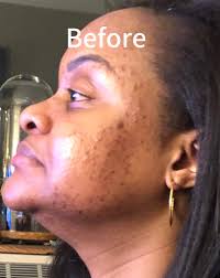 Derpin' is exhausting work.