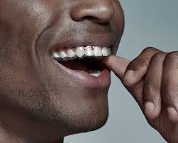 Best dent | i̇stanbul ataşehir diş kliniği (0216) 575 55 77. Bestsmile Aligner La Solution Pour Des Dents Droites