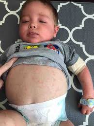 Fundraiser for Chris Pritchett by Jana Huffman Olin : Mason Pritchett Family