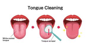Image result for black tongue symptoms