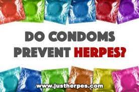 Pin On Herpes Facts