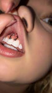 Smiley Piercing Amazing Photos And Important Information Tats N Rings